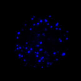 fluorescent blue sparkles in a circular shape atop a bed of darkness 