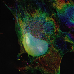 Kidney bean shaped teal globule entombed in neon green and blue webbing