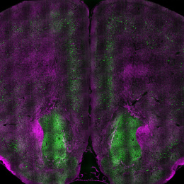 two mirrored neon purple bumpy hemispheres, each with a green round deposit near their base
