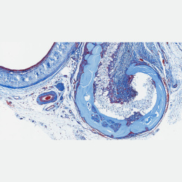 Chain of light blue round shapes curling in blue, white and red rivulets 