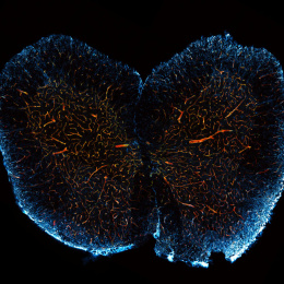 Two round glowing blue shapes reassembling human lungs filled with a network of shimmering orange rivulets  