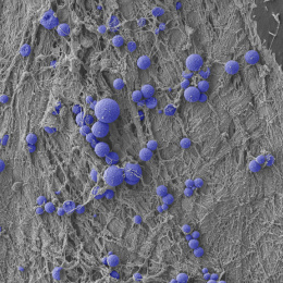 Purple spheroids strewn in constellation patterns atop a grey threaded landscape 