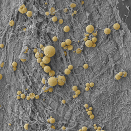 Yellow spheroids strewn in constellation patterns atop a grey threaded landscape 