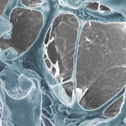 Ghostly grey and blue structures webbing over each other in dense clusters