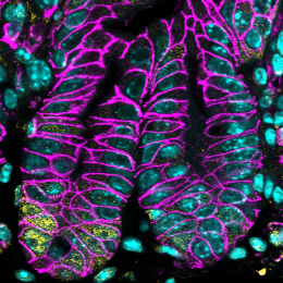 Bunched up glowing turquoise tube veined with neon magenta veins across black surface