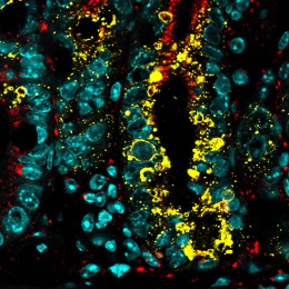 Teal jewel shapes spilled across black with a shock of yellow spatter off center right