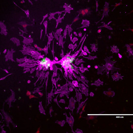 Jagged bursts of magenta and violet swirling into spatters across the dark