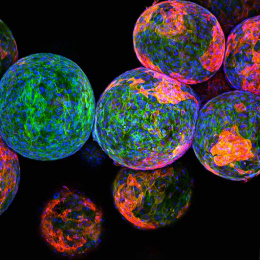 colorful alginate spheres