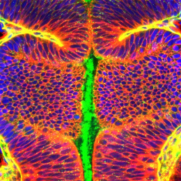 neural progenitor cells in a fish brain