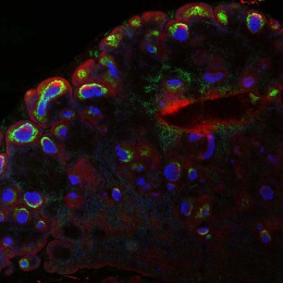 fluorescent cells in a lymph node