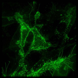 cells tagged with green fluorescent protein (GFP)