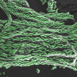 rope-like strands of polymer-coated nanoparticles in a bundle