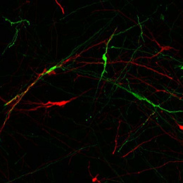 neuron comparison in red and green