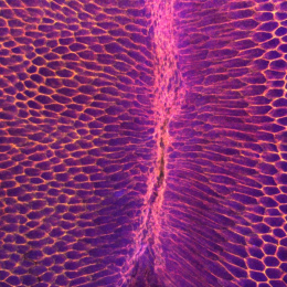 developing cells in a fruit fly egg
