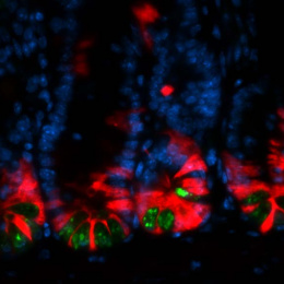 fluorescently stained colon epithelial cells