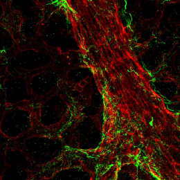 a network of blood vessels and protein fibers