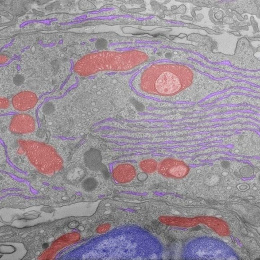 cells in grayscale with false color highlights in pink, purple, and indigo