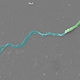 two worm-like strands colored turquoise and lime green, on a gray background