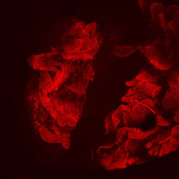 red cells on a black background with a gap in the middle