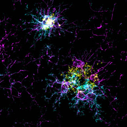 two clusters of fluorescently labeled brain cells