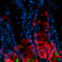 intestinal cells marked in red, blue, and green