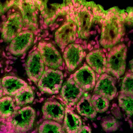 fluorescently stained cells in the colon