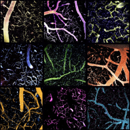 nine panels of fluorescent branches and spots