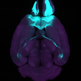 top view of a brain in purple, with cyan-marked regions at the top of the image