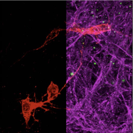 split-screen view of neurons, single color on the left, multi-color on the right