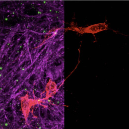 split-screen view of neurons, multi-color on the left, single color on the right
