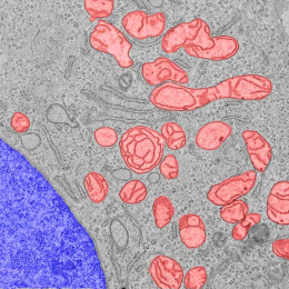 rounded red mitochondria against a grey background, with a large indigo structure in the bottom left corner