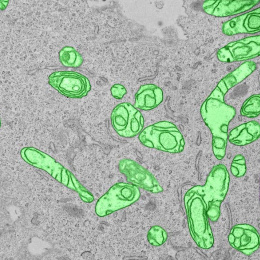 rounded and elongated mitochondria, colored green, against a grey background and large cellular structure in pink on the right