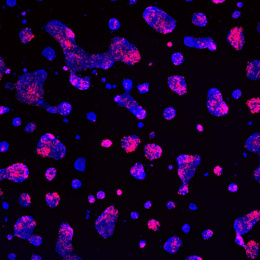clusters of red and blue cells glow against a black background