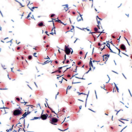 pink and purple-stained cells across a white field with blue lines scattered between them