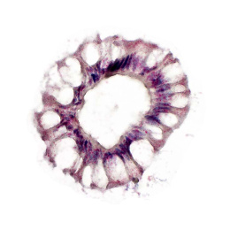 a donut-like ring of pink and purple stained cells with white gaps between them