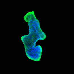 blue cells in a irregular blob with glowing green around the edges