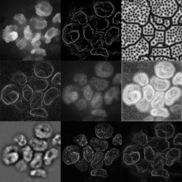 nine-panel greyscale mosaic of cells rendered with different photo effects