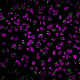 purple cells with green dots against a black background