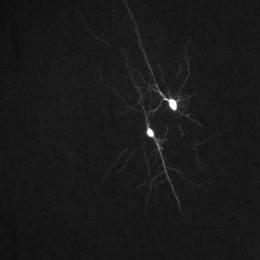 white neurons on a black field
