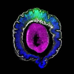 large purple cell surrounded by a ring of blue and green