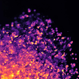 cells (in gold and magenta) disperse upward against a black background 