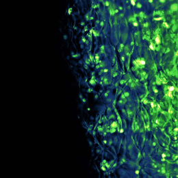 cells (in green) disperse against a black background