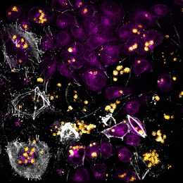 purple cells cluster at the top with bright yellow spots around the mass and fuzzy white clusters toward the left and bottom