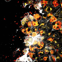The righthand two thirds of the image are filled with fiery-looking clusters of cells against a black background. In the middle, white structures spread in irregular blobs.