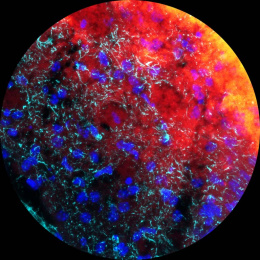A cloud of reddish nanoparticles fills the upper right half of a circle. The lower left is filled with blue and green cellular structures.
