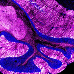folds of brain tissue in striated blue and magenta