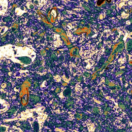 A field of round cells spreads across a horizontal field. Blue and purple cells are punctuated with green and orange cells, with cream-colored patches on the left.