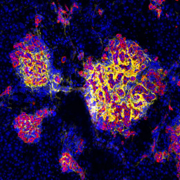 stylized clusters of various sizes contain interspersed cells in yellow, red, and blue