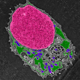 close-up view of a cell containing a large nucleus colored bright pink with various organelles to the lower right in green, dark grey, and purple