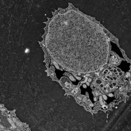 close-up black & grey view of a cell containing a large nucleus with various organelles to the lower right
